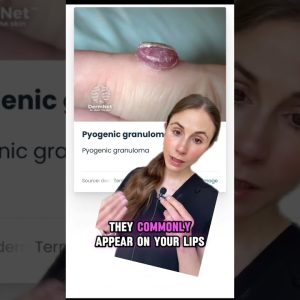 1764994346 maxresdefault