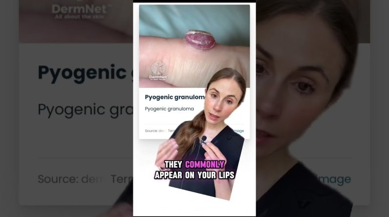 1764994346 maxresdefault