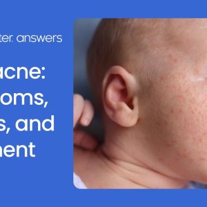 1765000456 maxresdefault