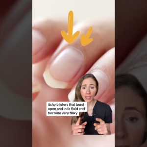 1765001634 maxresdefault