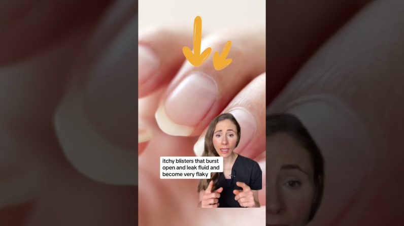 1765001634 maxresdefault