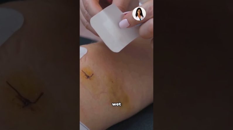 1765003198 maxresdefault