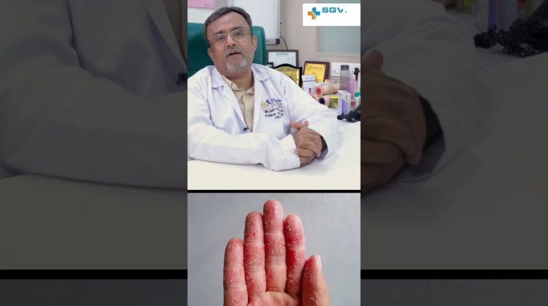 1765005114 maxresdefault