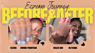 1765006854 maxresdefault