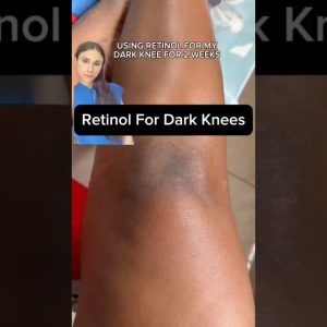 1765016141 maxresdefault