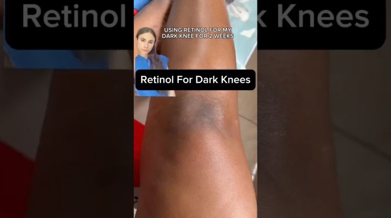 1765016141 maxresdefault