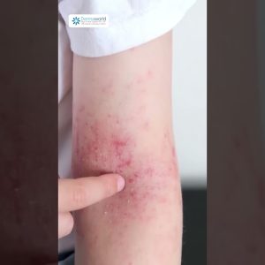 1765019996 maxresdefault