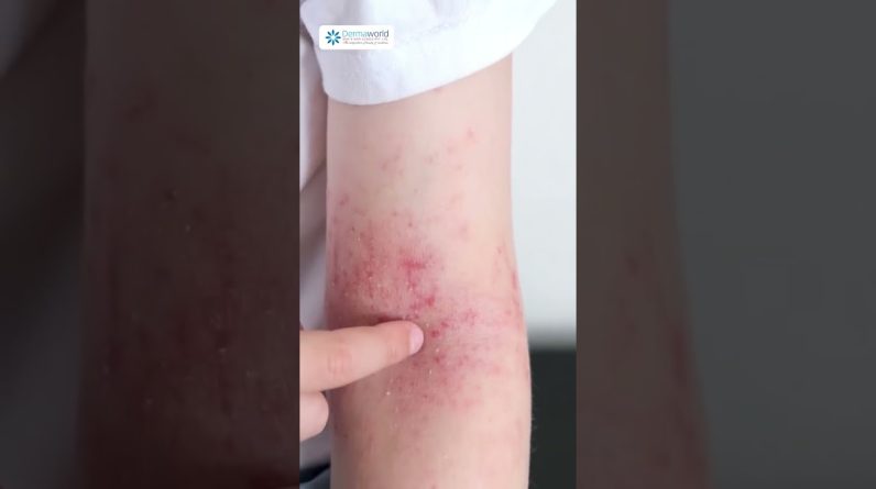 1765019996 maxresdefault