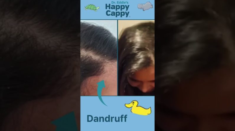 1765023472 maxresdefault