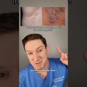 1765048991 maxresdefault