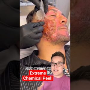 1765055455 maxresdefault