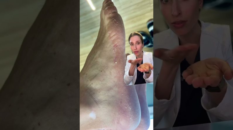 1765058020 maxresdefault