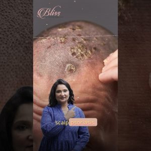 1765063020 maxresdefault