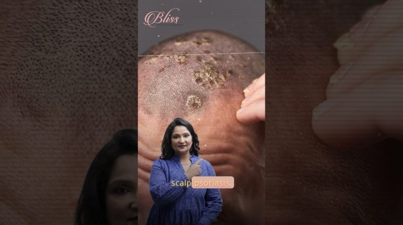 1765063020 maxresdefault