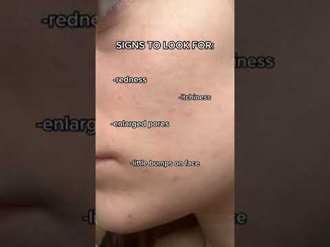 1765063707 hqdefault