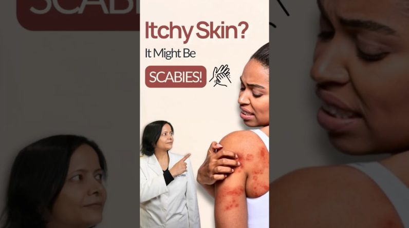 1765063846 maxresdefault