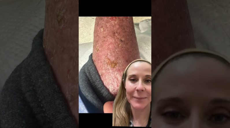 1765073977 maxresdefault