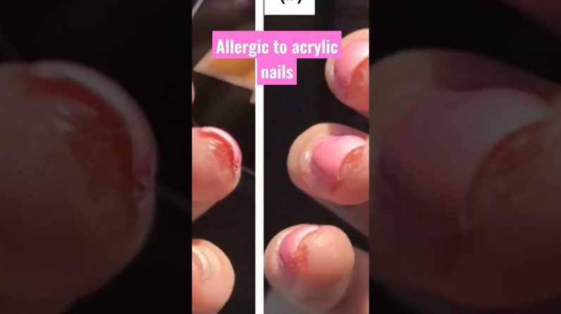 1765088394 maxresdefault