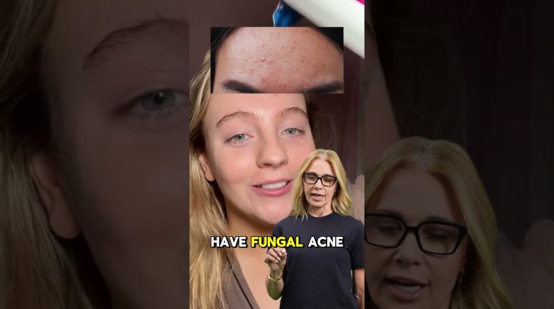 1765099626 maxresdefault