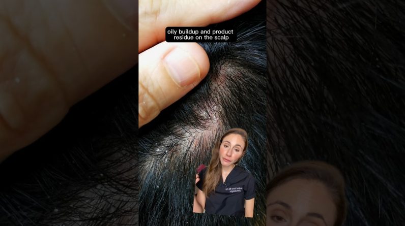 1765114090 maxresdefault