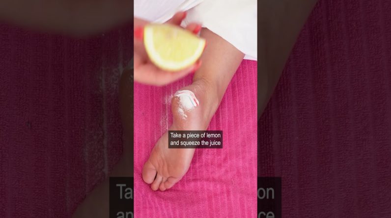 1765122506 maxresdefault