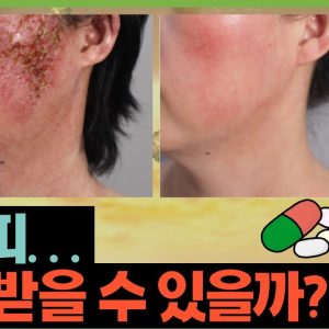 1765127701 maxresdefault