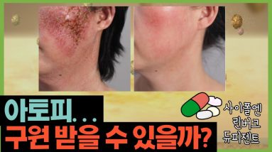 1765127701 maxresdefault