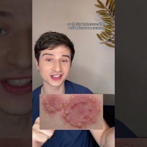 1765150762 maxresdefault