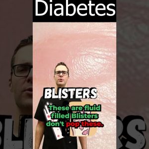 1765158027 maxresdefault