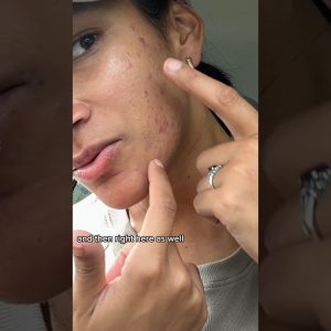 1765158105 maxresdefault