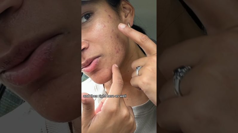 1765158105 maxresdefault