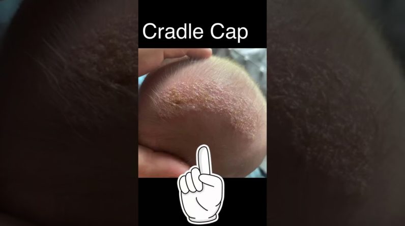 1765159022 maxresdefault