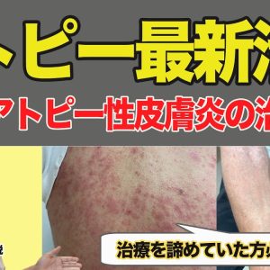 1765164303 maxresdefault