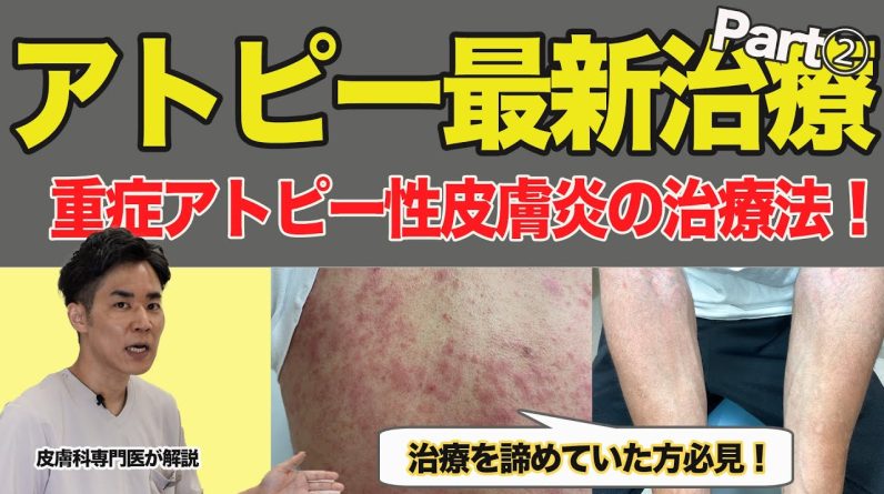 1765164303 maxresdefault