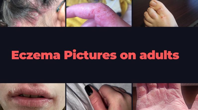 1765181340 maxresdefault