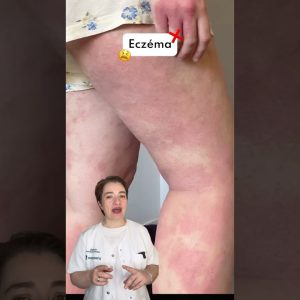 1765183820 maxresdefault