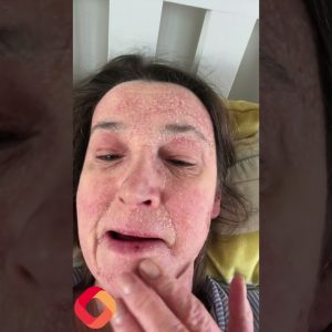 1765186256 maxresdefault