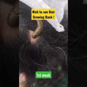 1765192330 maxresdefault