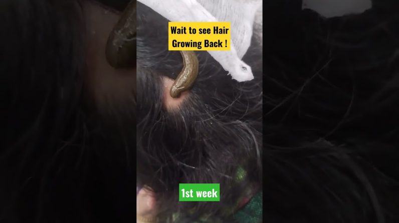 1765192330 maxresdefault