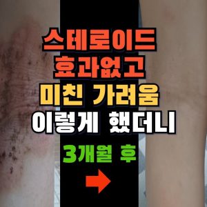 1765193575 maxresdefault