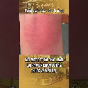 1765197237 maxresdefault