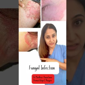 1765199635 maxresdefault