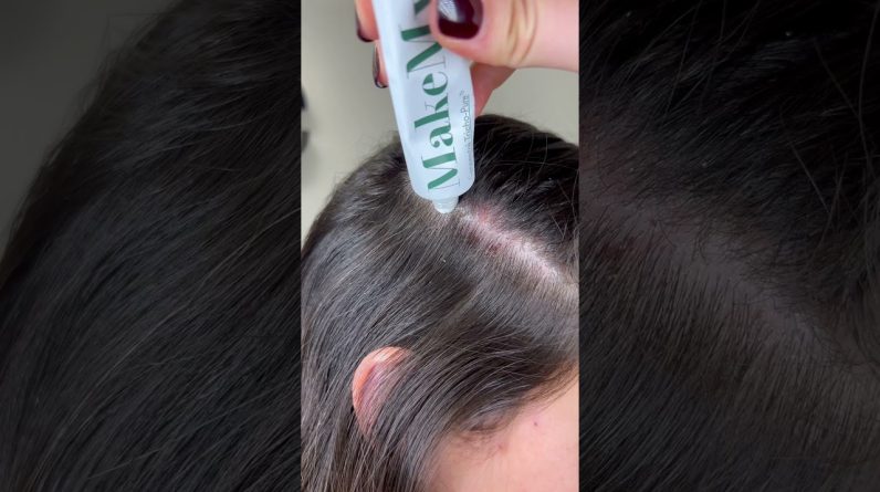 1765199709 maxresdefault