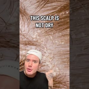 1765206963 maxresdefault