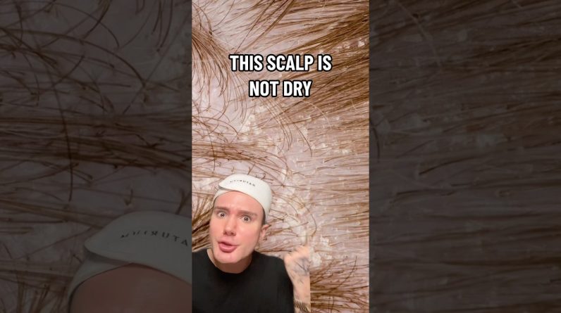 1765206963 maxresdefault