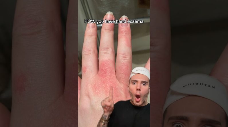 1765224578 maxresdefault