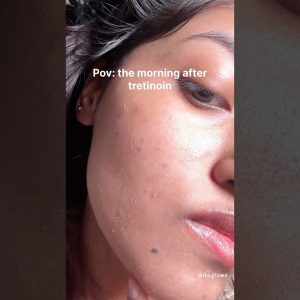 1765242894 maxresdefault