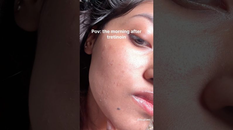 1765242894 maxresdefault