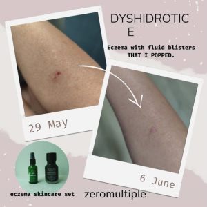 1765246074 maxresdefault