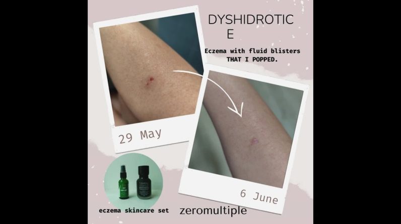 1765246074 maxresdefault